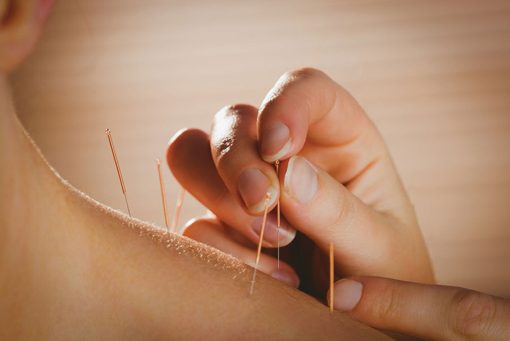 5 Best Acupuncturists in Brighton - Natural relief for chronic pain